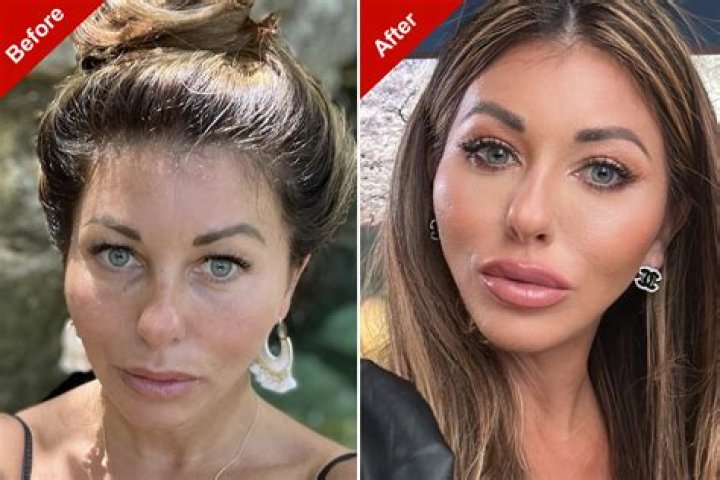 Did Leva Bonaparte Get Plastic Surgery? Was She Prettier Before the Surgery?